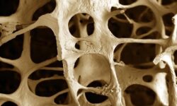 Plantas medicinales para osteoporosis