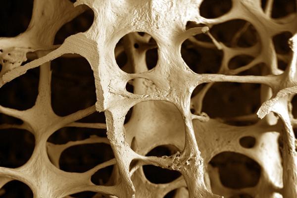 Plantas medicinales para osteoporosis