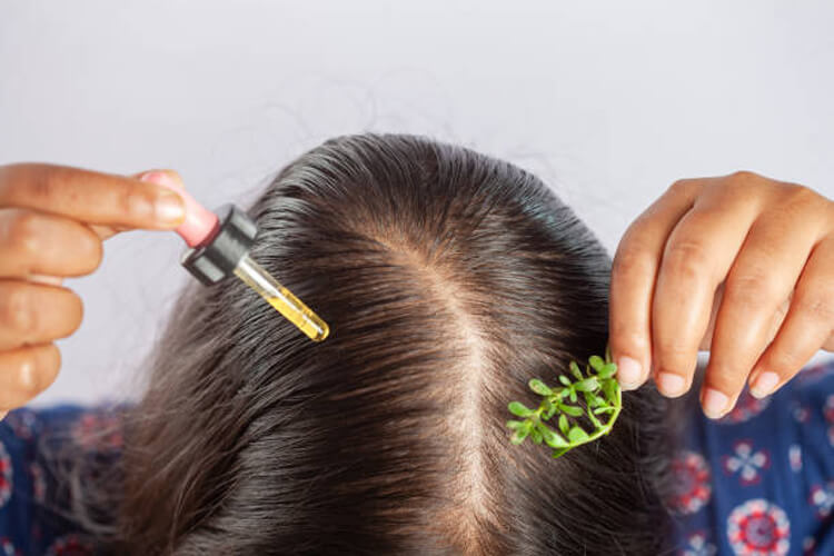 Remedios naturales para la caída del cabello Remedios naturales para la caída del cabello: Guía para fortalecer y estimular el crecimiento capilar